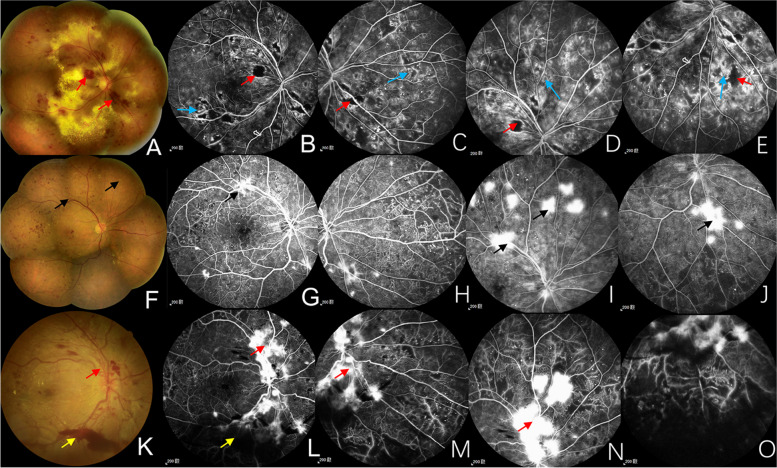 Fig. 1