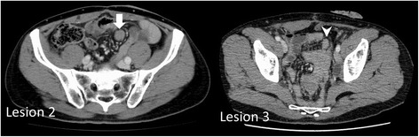 Fig. 2