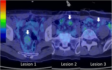 Fig. 4