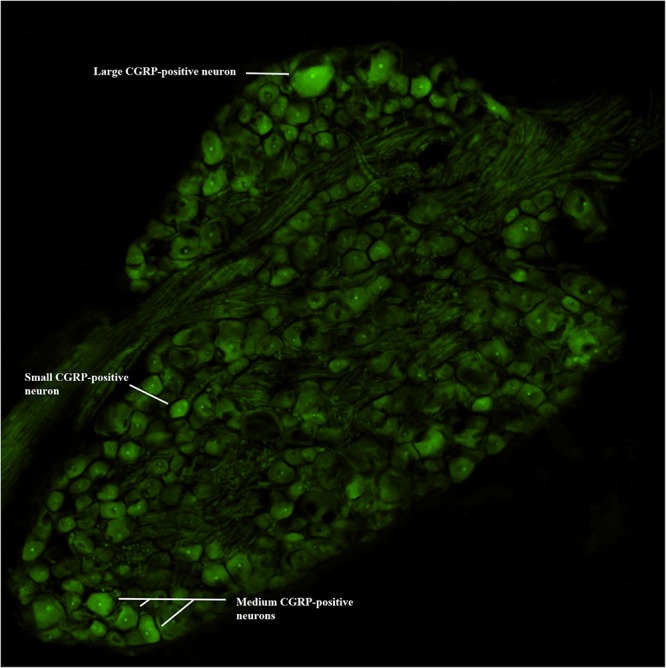 FIGURE 2