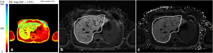 Fig. 4