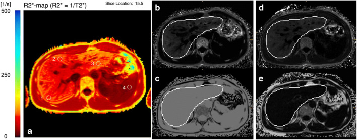 Fig. 5