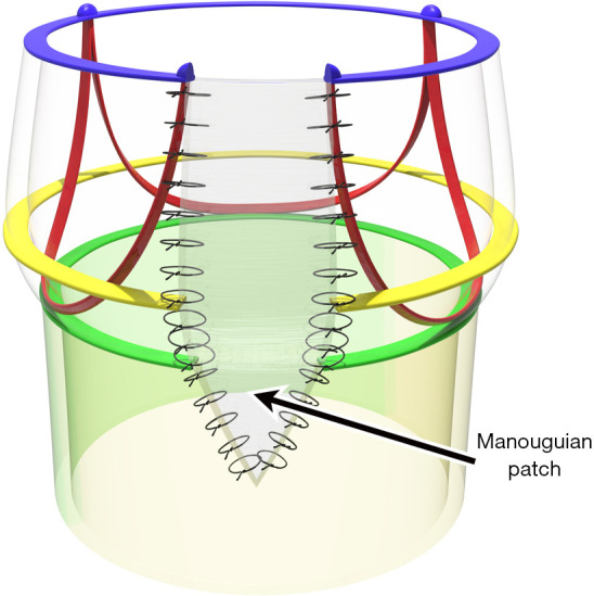 Figure 9