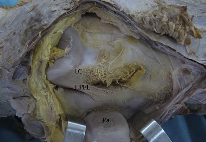 Fig. 1