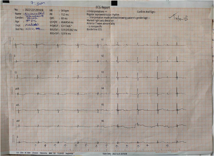 FIGURE 1