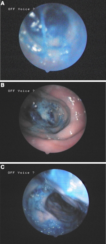 Fig. 4