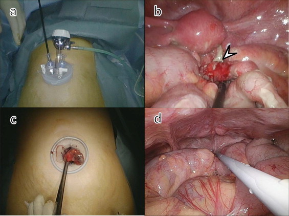 Fig. 3