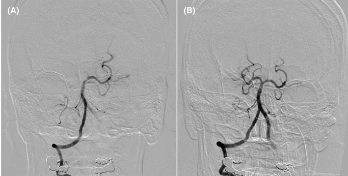 FIGURE 3