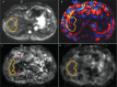 Fig 3.