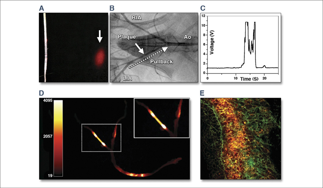 Figure 11