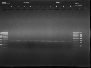 Fig 3: Polymerase Chain Reaction.