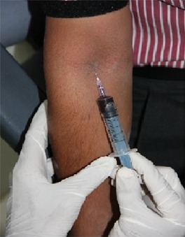 Fig 1: Collection of Blood Samples