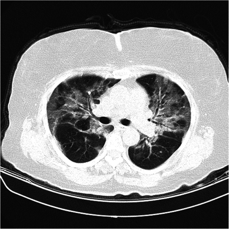 Fig. 1