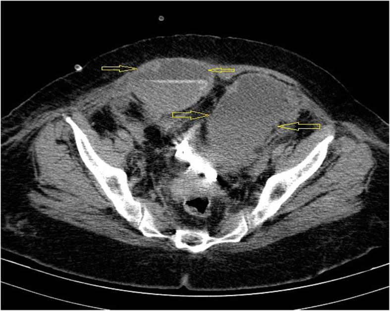 Fig. 2
