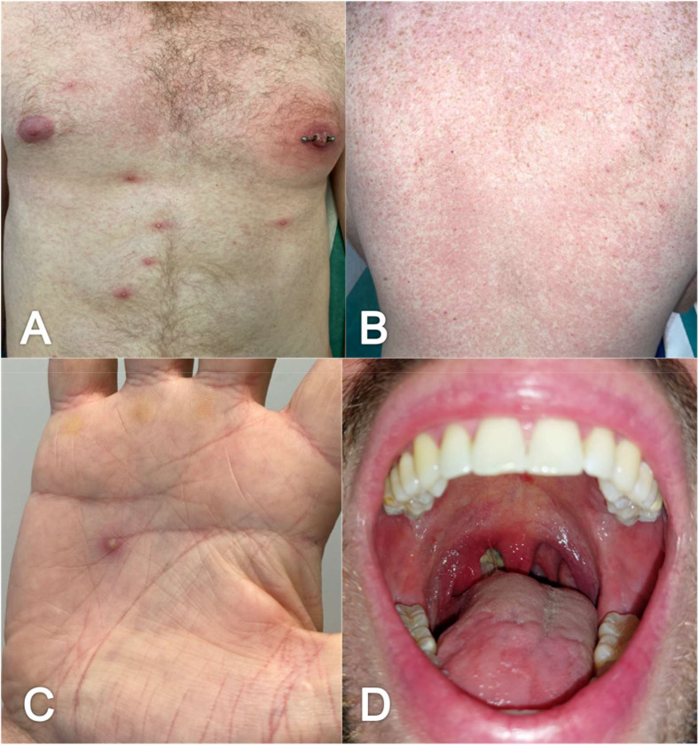 Fig. 2