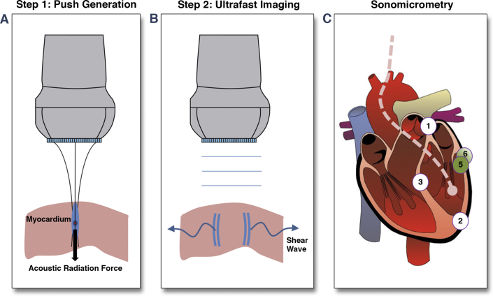 Figure 1