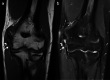Fig. 11