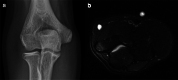 Fig. 10