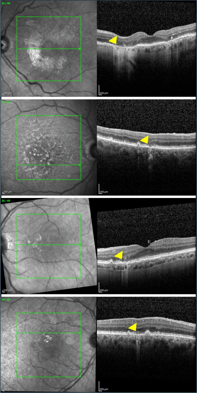 Fig. 1