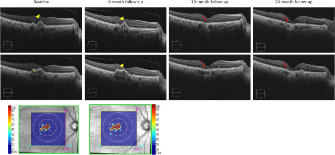 Fig. 2