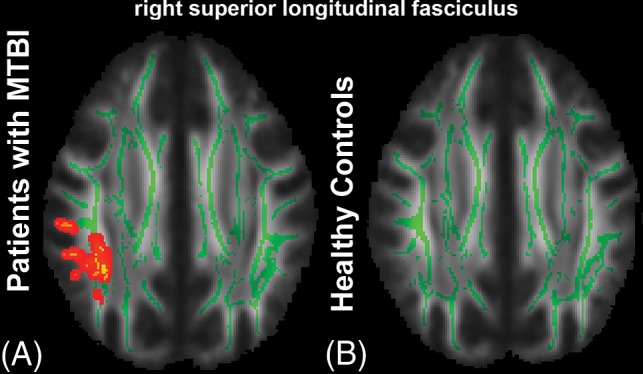 Fig 1.