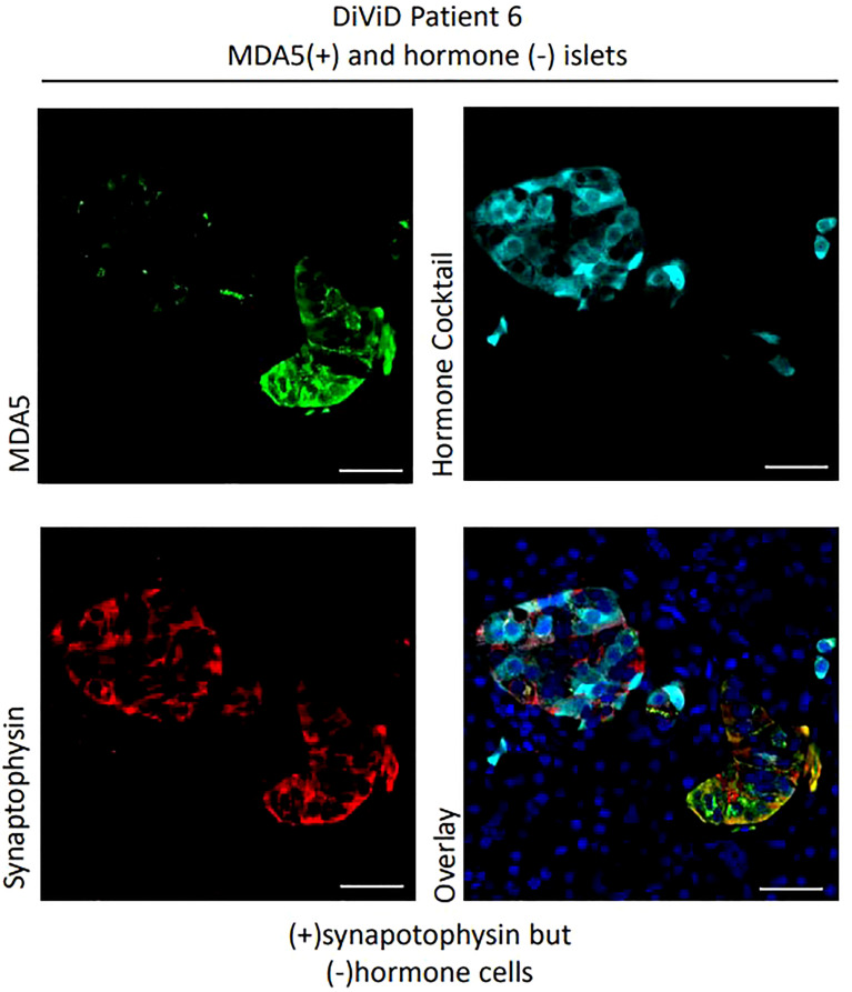 Figure 4