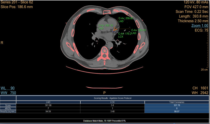 Figure 1.