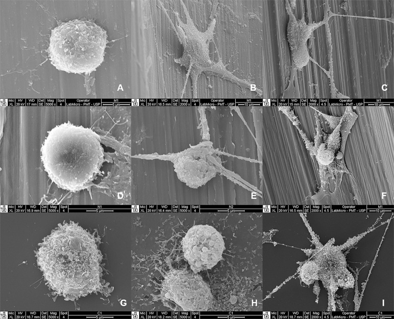 Figure 2. Osteoblasts at 24, 48, and 72 hours on the mini-implants and polystyrene. (A to C) Morelli; (D to F) Neodent; (G to I) polystyrene.