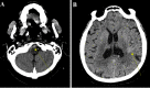 FIG. 1.