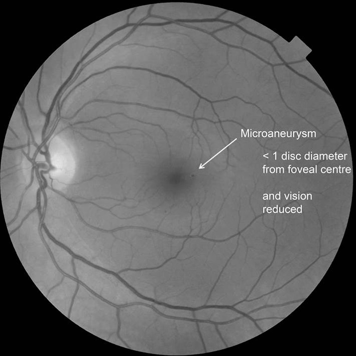 Fig. 4