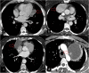Fig. 15