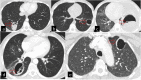 Fig. 6
