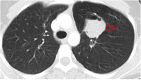 Fig. 10.