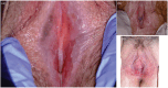 FIGURE 14