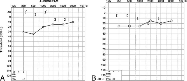 Fig 3.