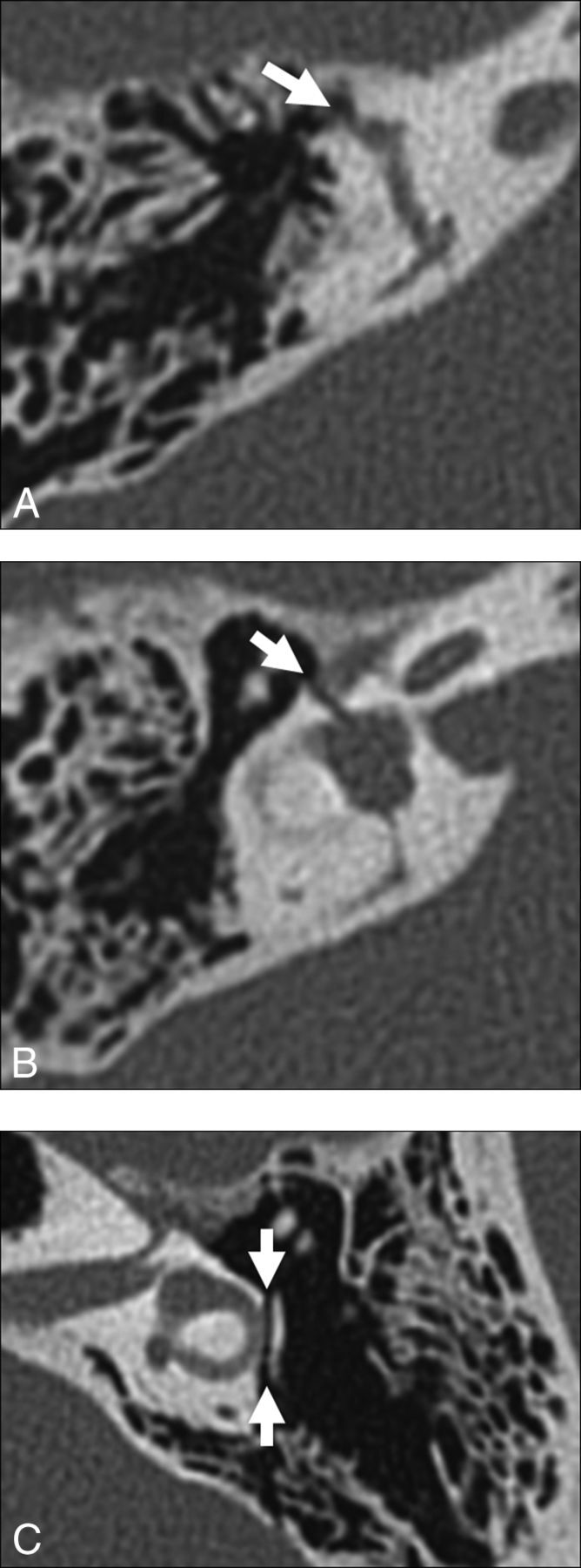 Fig 11.