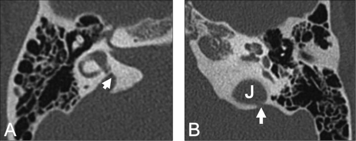 Fig 13.