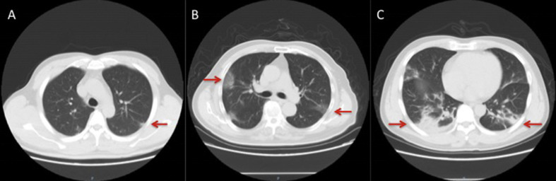 Fig. 2