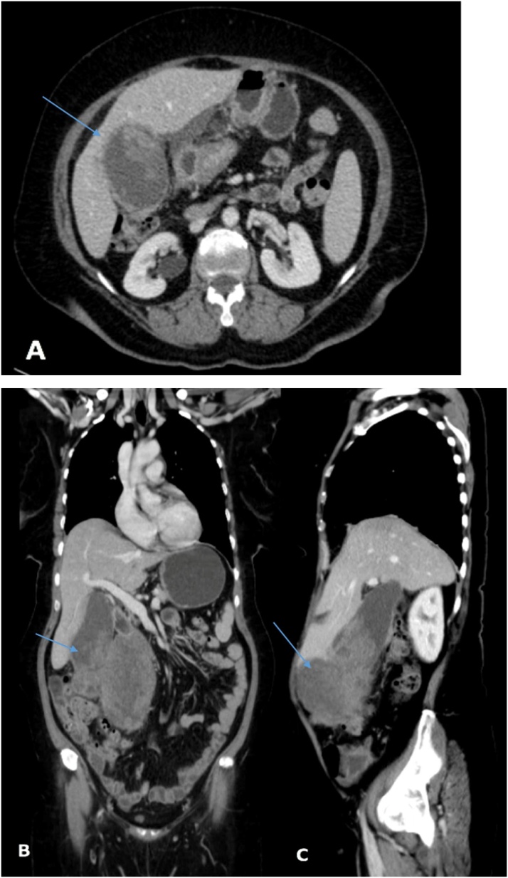 Fig. 3