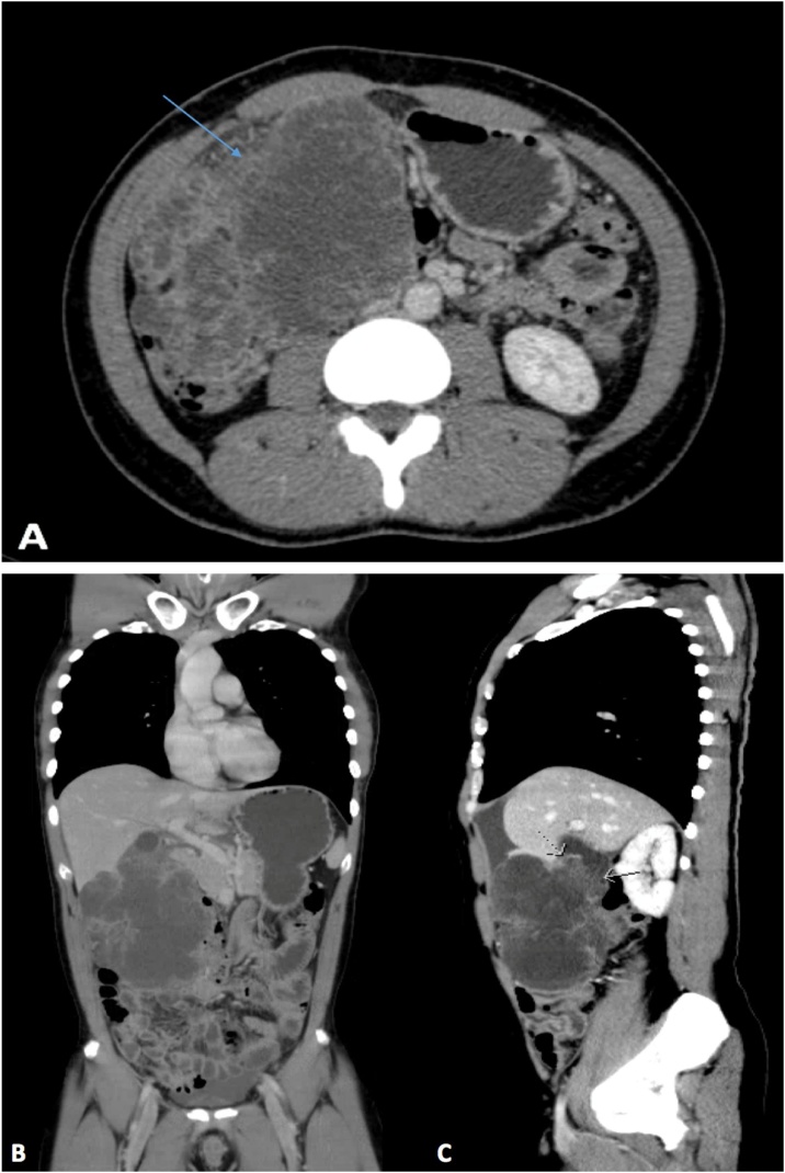 Fig. 1