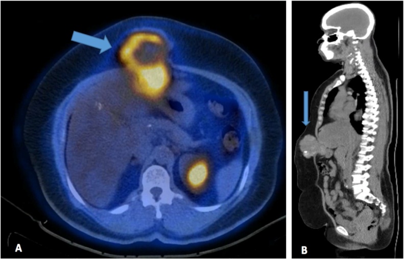 Fig. 6