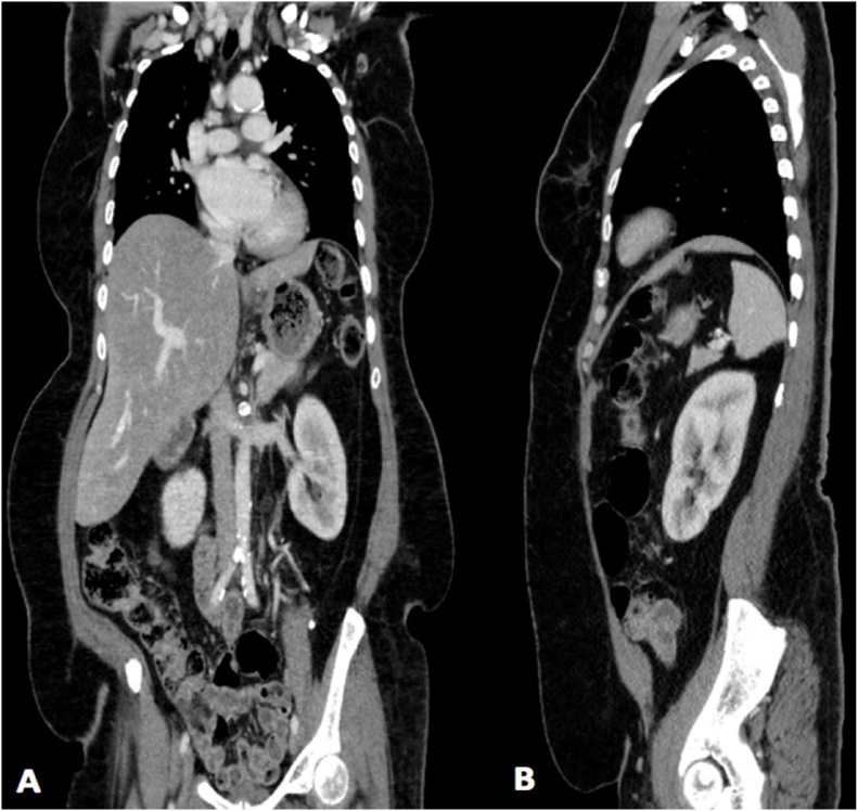 Fig. 7