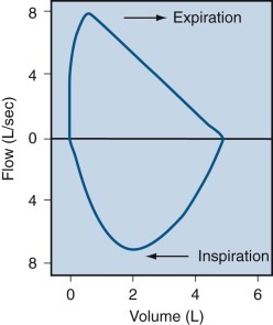 Figure 25-6