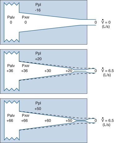 Figure 25-1