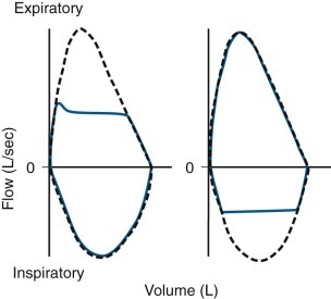 Figure 25-8