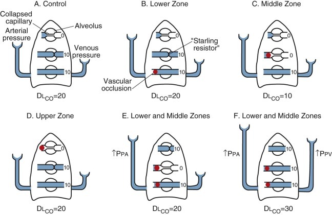 Figure 25-16