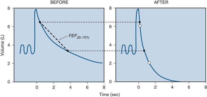 Figure 25-17