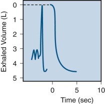 Figure 25-3