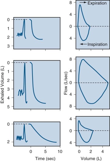 Figure 25-15