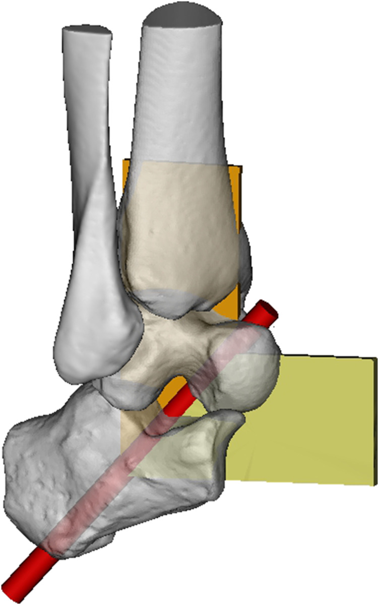 FIGURE 3